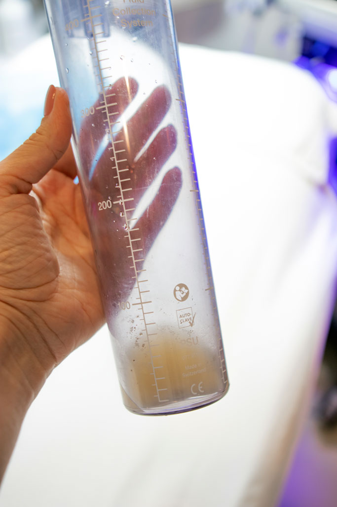 Blame it on Mei Miami Fashion Blogger What is Hydrafacial